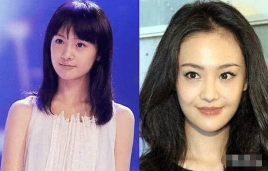 坦然面對(duì)整容,女明星的美麗新篇章之旅