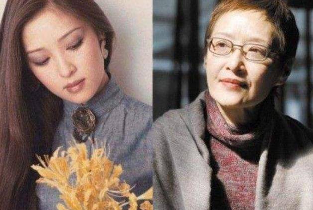 坦然面對(duì)整容,女明星的美麗新篇章之旅