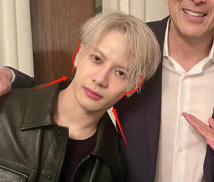 深度解析明星整容后遺癥,觀點與影響探討