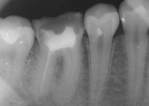 中國再生牙齒研究新進展,重塑微笑,科技引領牙齒再生新篇章
