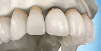 中國再生牙齒研究新進(jìn)展,重塑微笑,科技引領(lǐng)牙齒再生新篇章