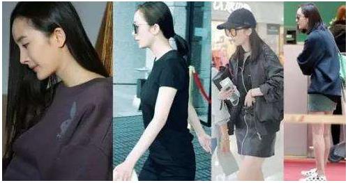 駝背男明星的人生舞臺(tái),身體特征與星光熠熠的輝煌探索