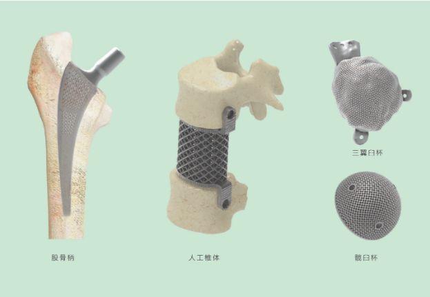 三維打印髖關(guān)節(jié)技術(shù)新動態(tài),重塑生活的科技魔法奇跡