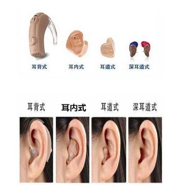 惠耳聽(tīng)力助聽(tīng)器價(jià)格,時(shí)代變遷中的印記與價(jià)格走勢(shì)分析