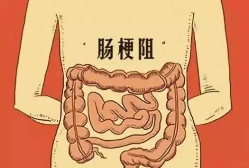 高科技產(chǎn)品重塑生活,體驗(yàn)前沿魅力,探索腸鳴最新技術(shù)