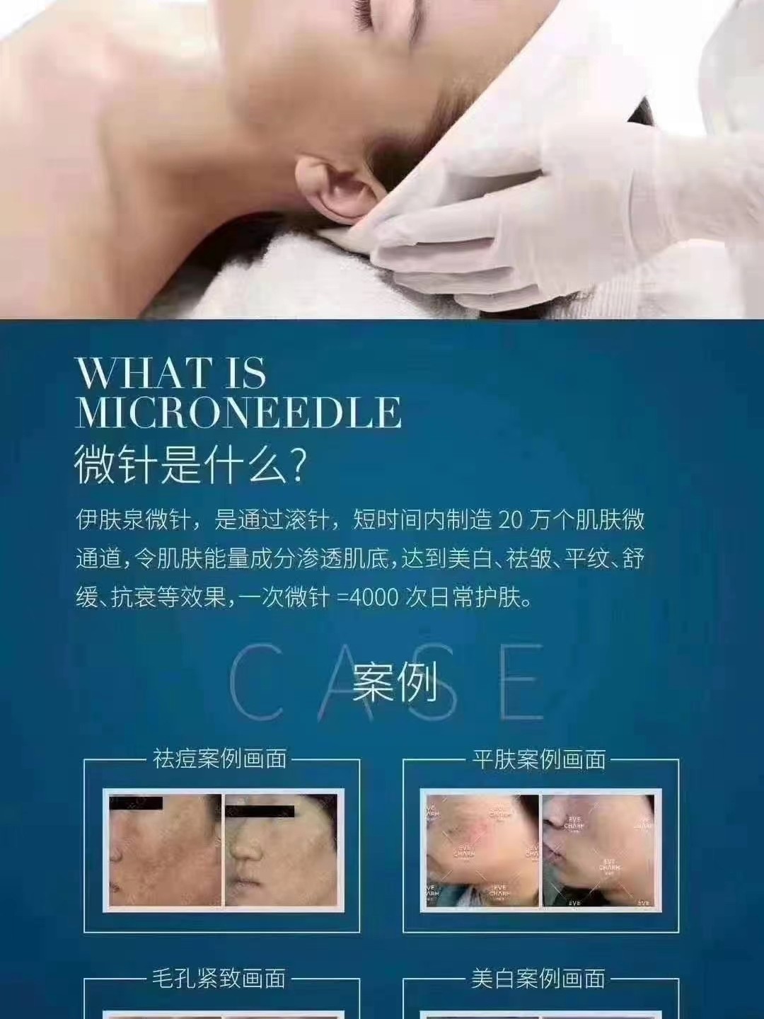 微針最新技術(shù)揭秘,三大革新重塑美容行業(yè)未來(lái)