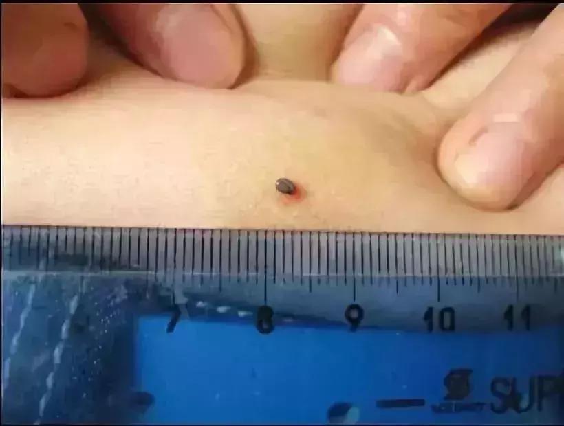 小明快樂疫情日志,最新疫情發布與日常觀察