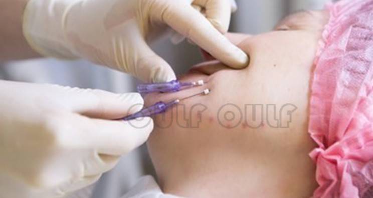 線雕最新手法,背景、發展、時代地位及展望